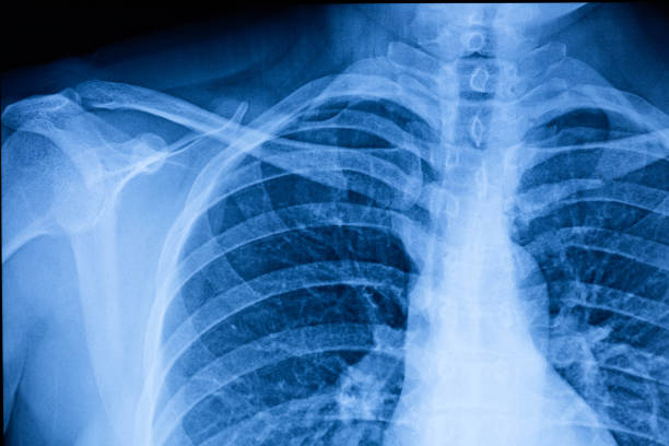 XRAY